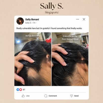 Bara'a Hair Potion - Scalp & Hair Elixir Oil