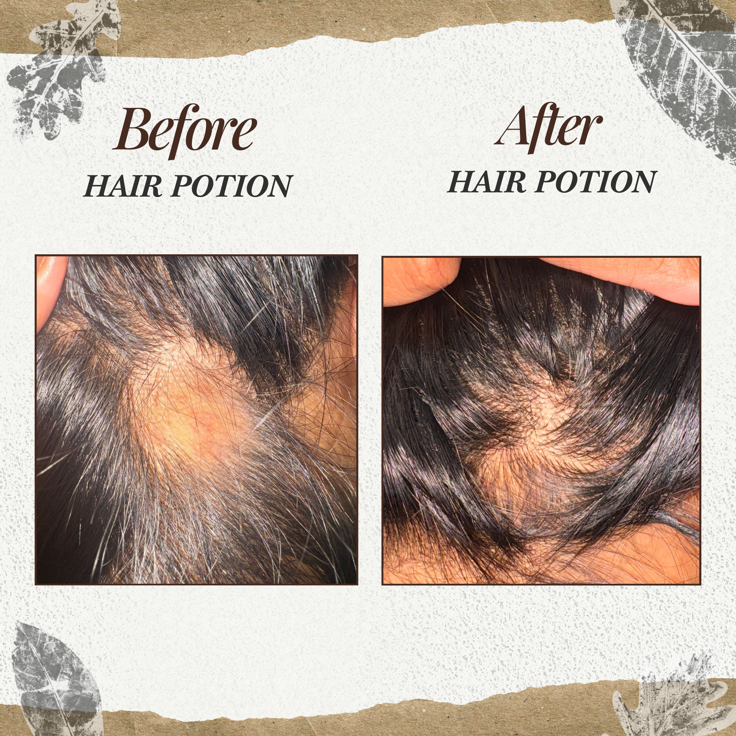 Bara'a Hair Potion - Scalp & Hair Elixir Oil