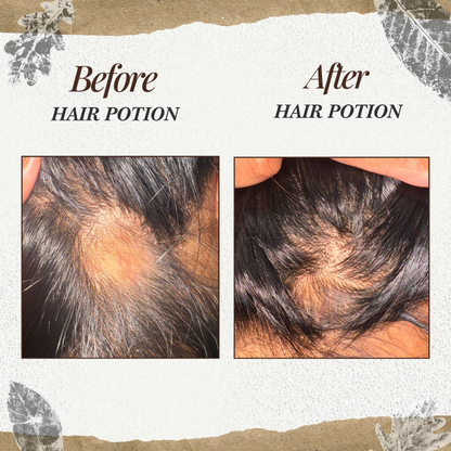 Bara'a Hair Potion - Scalp & Hair Elixir Oil