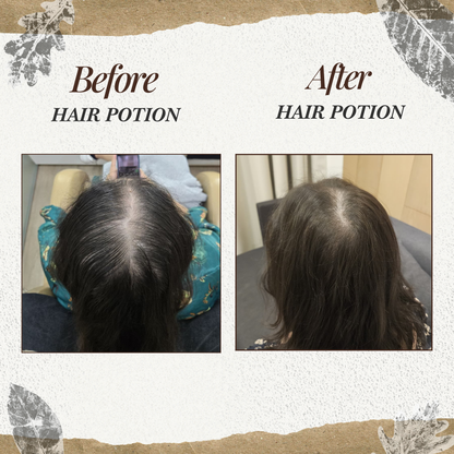 Bara'a Hair Potion - Scalp & Hair Elixir Oil